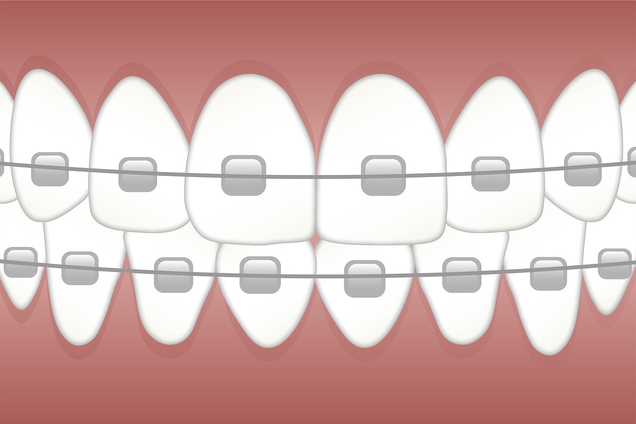 orthodontics